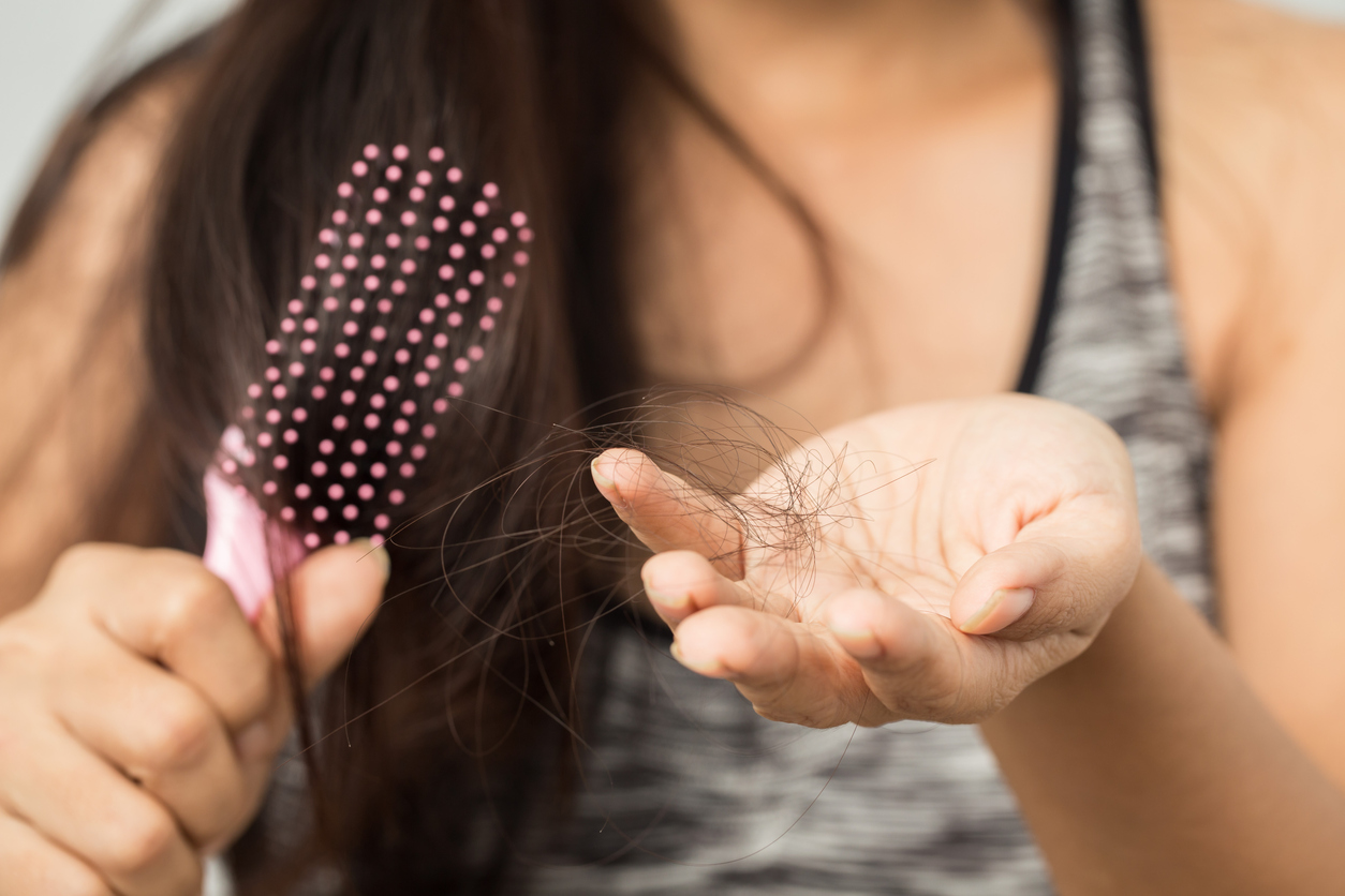 Women Suffer From Hair Loss Too